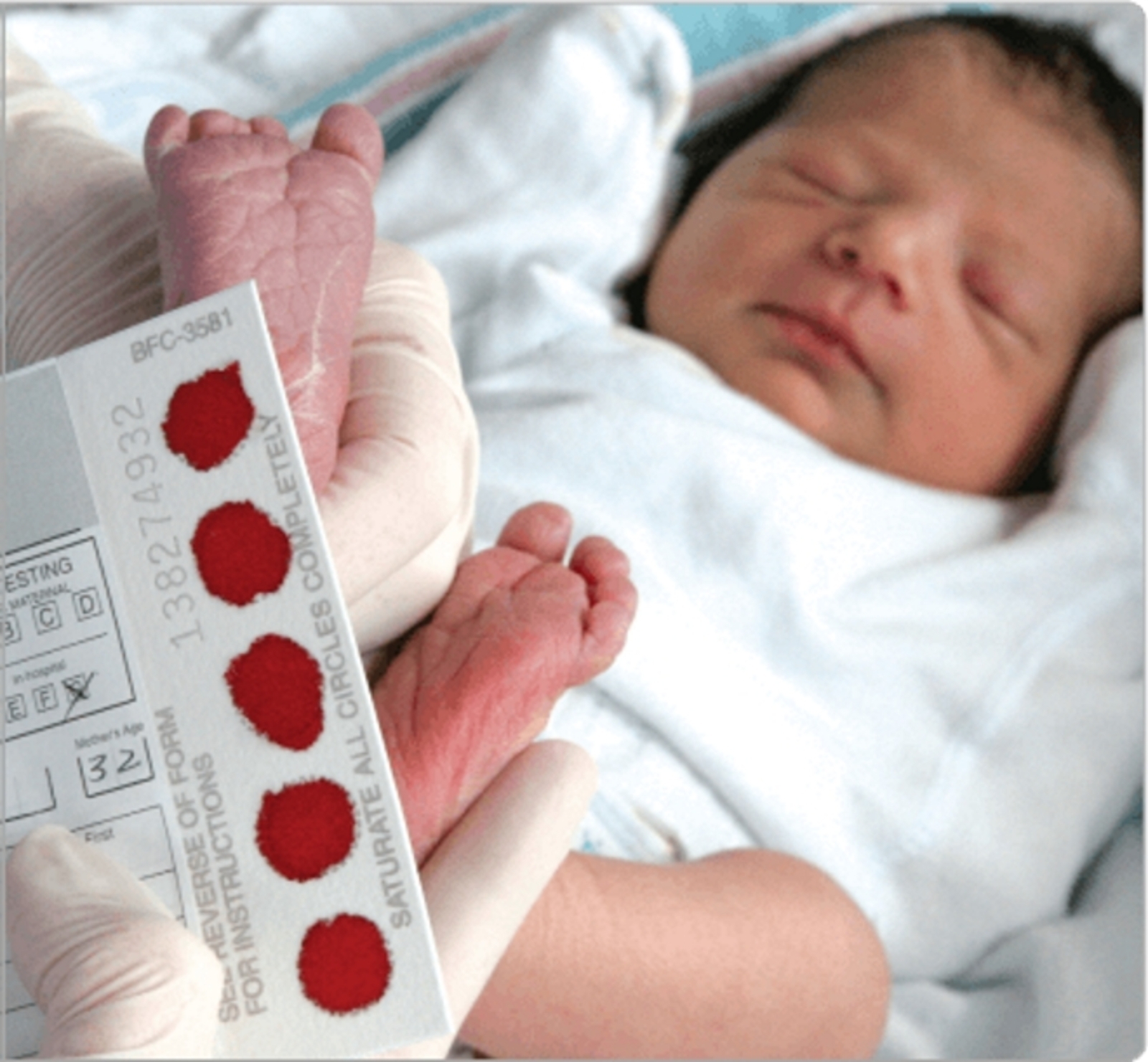 Расширенный неонатальный скрининг новорожденных - что меняется в 2023 году